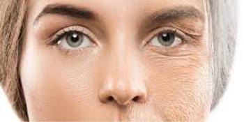 علت شل شدن پوست و معرفی محصولات سفت کننده پوست صورت و بدن 