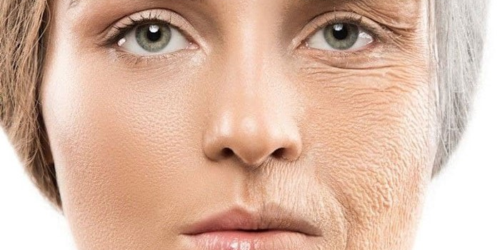 6 گام تا درمان خشکی پوست صورت 