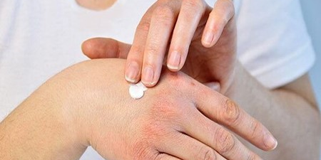 4 اقدام کلیدی برای رفع خشکی پوست دست در منزل 